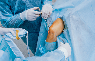 Knee Arthroscopy