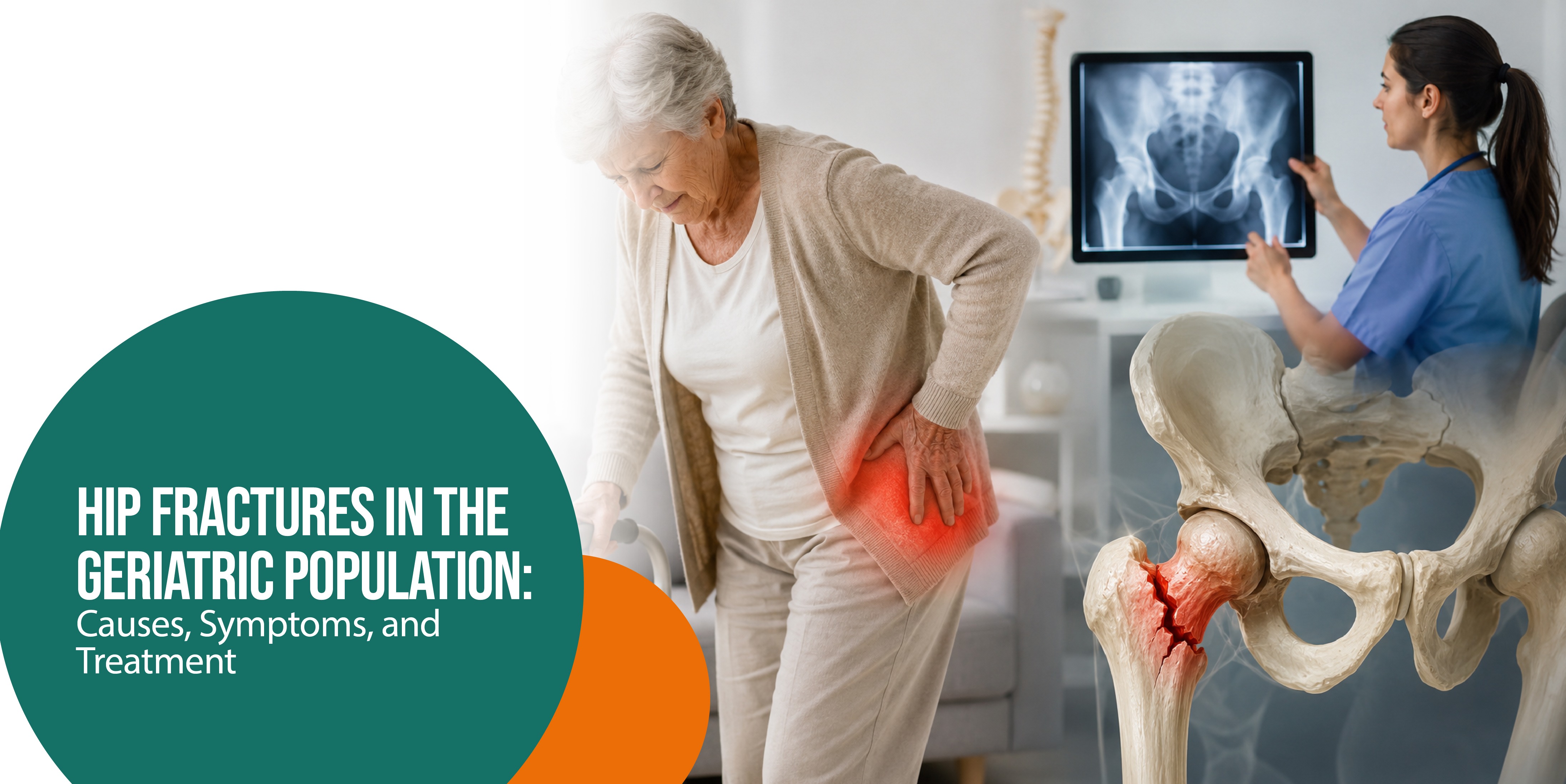 Hip Fractures in the Geriatric Population