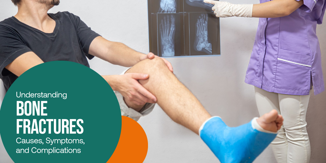 Understanding Bone Fractures